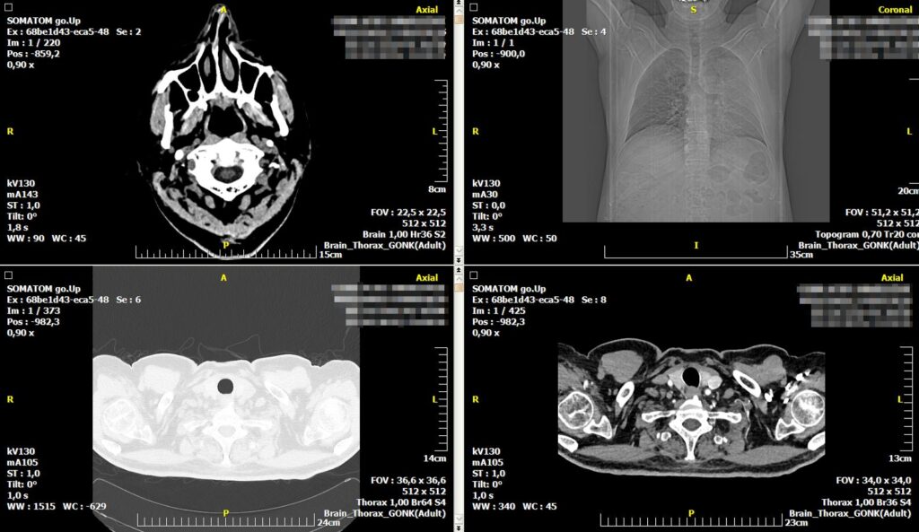 mri screenshot